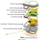 Illustration for article titled This wireless brain implant could make telekinesis a reality